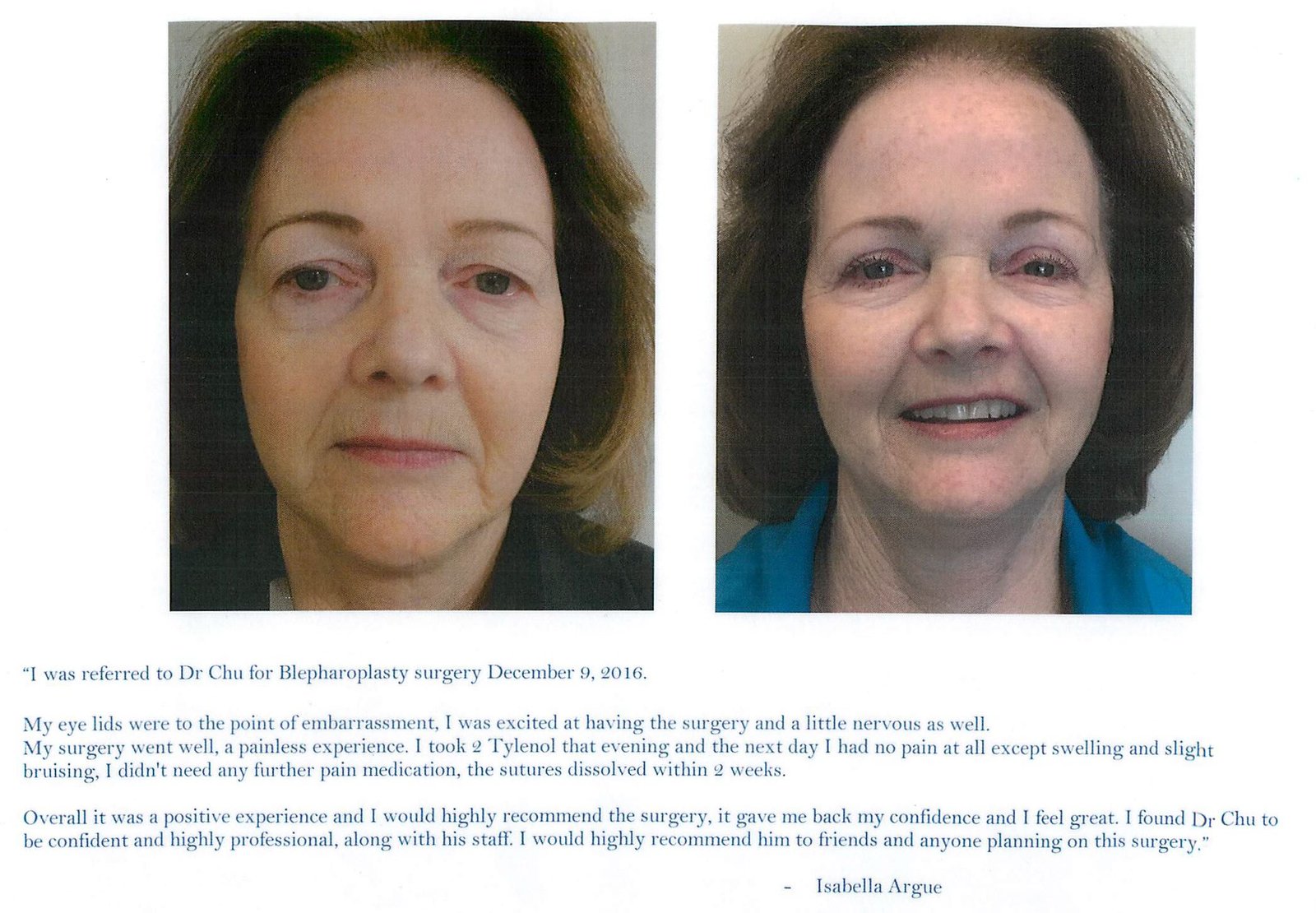 Blepharoplasty Surgery